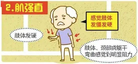世界帕金森病日：关于帕金森，那些你应该知道的事